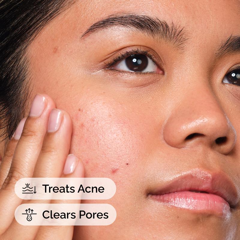 HeavenCare 3-Step Acne Repair Kit